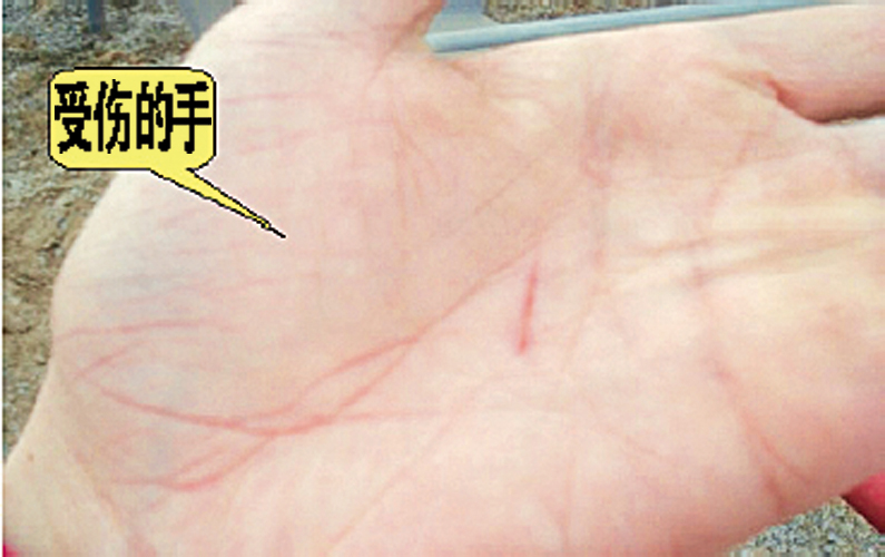 急救箱事件
