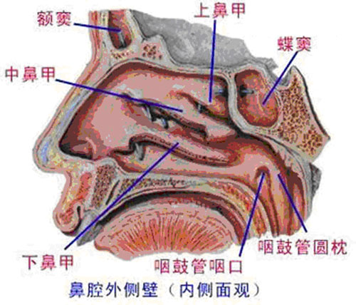 如何防治真菌性鼻窦炎(上)
