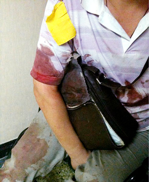 频发电梯事故折射出什么