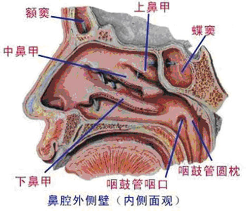 如何防治真菌性鼻窦炎(下)